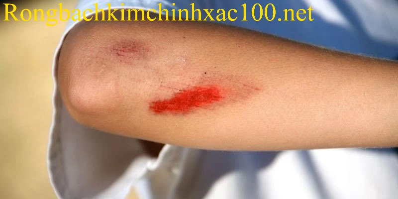 Điềm báo và con số may mắn khi chiêm bao thấy bị thương